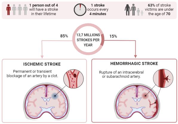 Fig. 1 Epidemiology and definitions of ischemic and hemorrhagic strokes