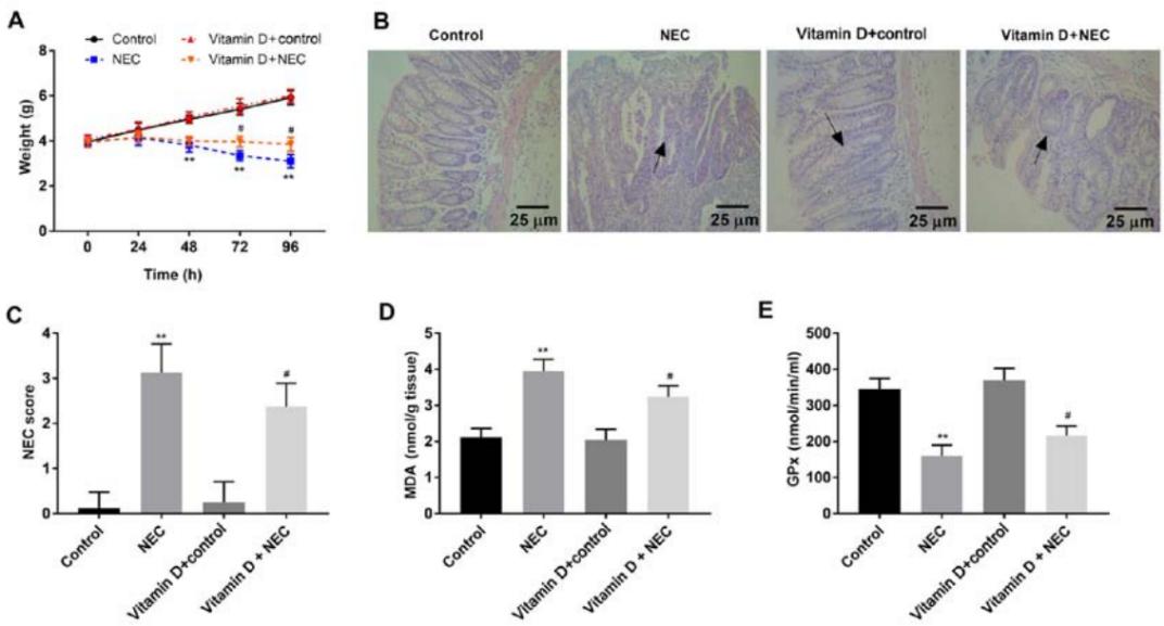 Fig. 3 Vitamin D reduces intestinal tissue damage and oxidative stress in NEC mice. (A) Body weight (g) of mice. (B) Histopathological changes were observed by haematoxylin and eosin staining. (C) Intestinal tissue damage was assessed by NEC score. (D) Levels of MDA in intestinal tissues. (E) Levels of GPx in intestinal tissues.